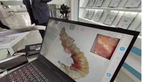  3D打印技術(shù)在牙科義齒領(lǐng)域中牙套制作的應(yīng)用是怎樣的呢？(圖2)